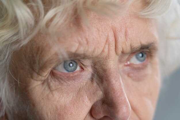 Возрастные изменения в мышцах глаза